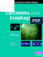 Carcinoma of Oesophagus