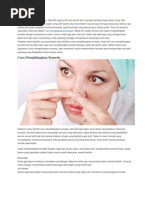 Download Cara Menghilangkan Komedo by Jusman Bae SN174051332 doc pdf