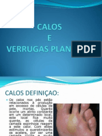 Calos e verrugas plantares: causas, tratamento e prevenção