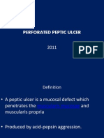 Perforated Peptic Ulcer Symptoms and Diagnosis