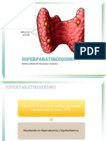 27 Hiperparatiroidismo