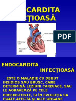 Endocardita Infectioasa