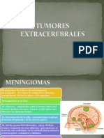 Tumores Extracerebrales