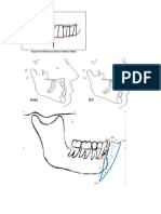 Plano Oclusal