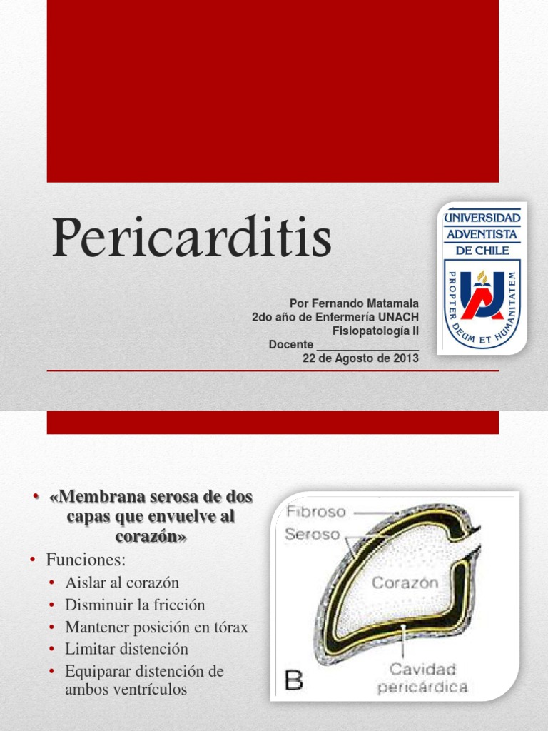 Pericarditis Final | PDF | Inflamación | Virus