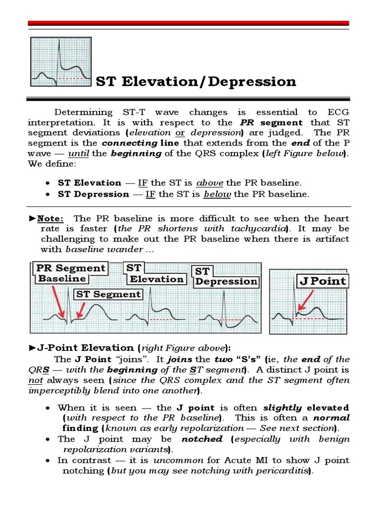 ECG PG 46 ST Elevation Smiley Early Repol (7 17.1 2011) LOCK | PDF ...