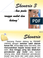 PPT Sinusitis