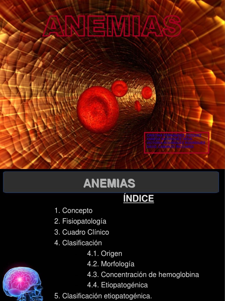 Clasificación y Fisiopatología de Anemias | PDF | Anemia | Glóbulo rojo
