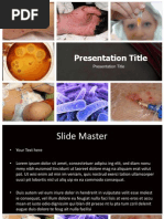 Download Sepsis Powerpoint Template by Presentation Templates SN174999695 doc pdf