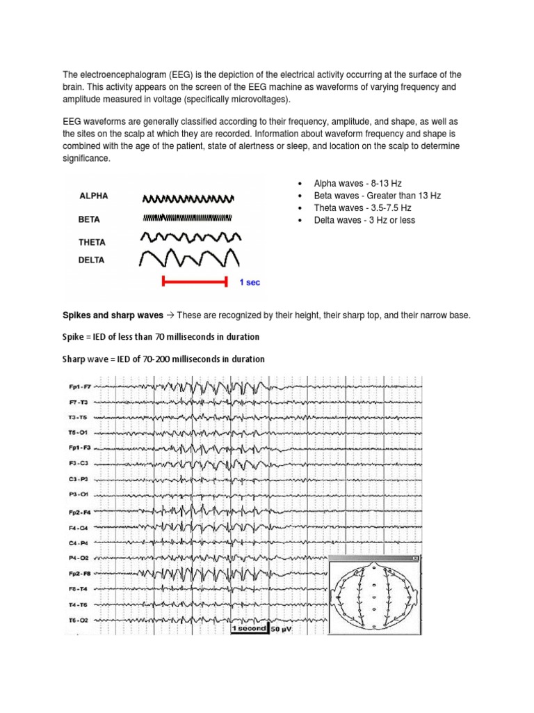 EEG Waveform Classification Overview | PDF