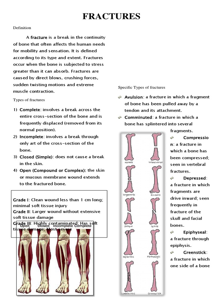 Fractures | Bone | Wound