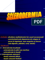 Sclerodermia