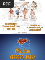 Download cerebral palsycez by Frances Anne Bautista Abe SN17571351 doc pdf
