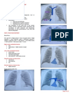 Cardiac Radiology