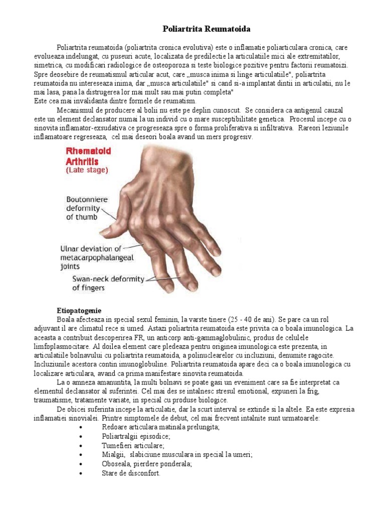poliartrita cronica evolutiva tratament cum să tratezi o articulație inflamată a degetului