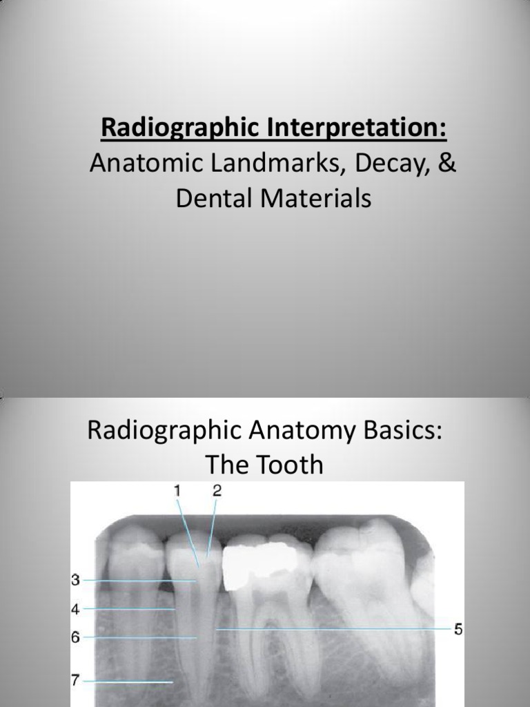 Radiographic Interpretation PPOINT PDF Dentistry Mouth