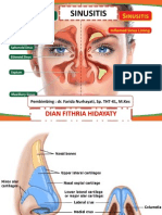 Sinusitis Dian