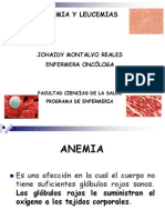 Anemia y Leucemias