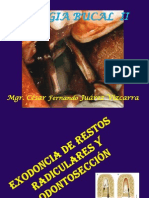 1 Exodoncia de Restos Radiculares Complejas y Odontosección