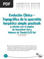 Queratitis Herpetica Post Laser