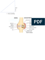 Cardinal Sign Osteoartritis