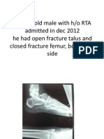 21 Yr Old Male Admitted in Dec 2012 with Fractures