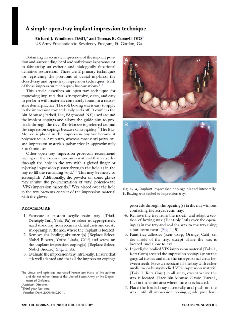Open Tray Impression Technique Dental Implant Health Care