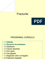 Fracturile