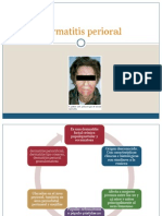 Dermatitis Perioral