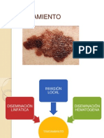 Tratamiento Melanoma