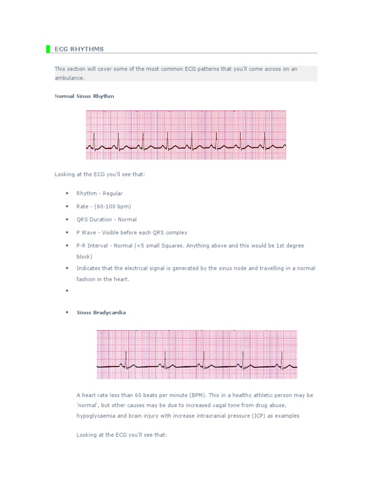 ECG Rhythms | PDF