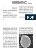 Folicular Thyroid