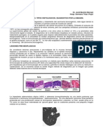 Carcinoma Broncogenico