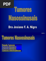 Tumores+Nasossinusais