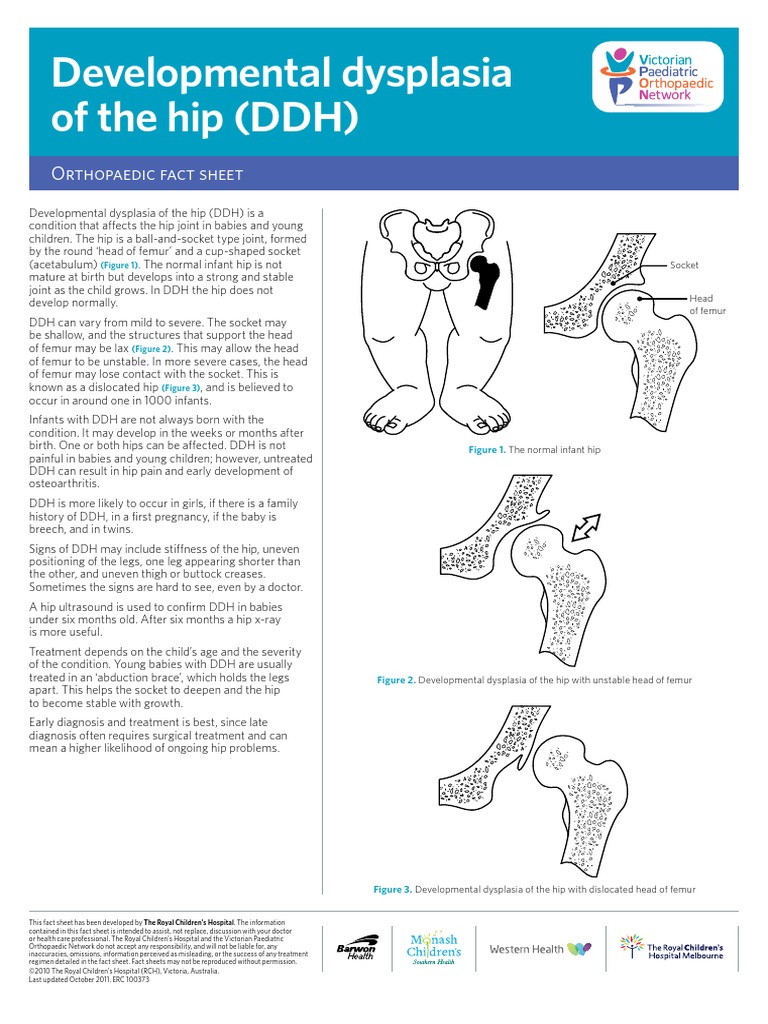 Dysplasia Hip Facts Medical Specialties Clinical Medicine