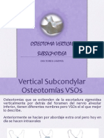 Osteotomia Vertical Subsigmoidea