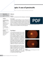 Dangerous Diplopia - Pansinusitis