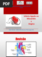 Aula Angina e IAM_ Ana Néri