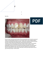 Fluorosis