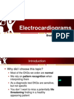 Electrocardiograms in The Pediatric ED