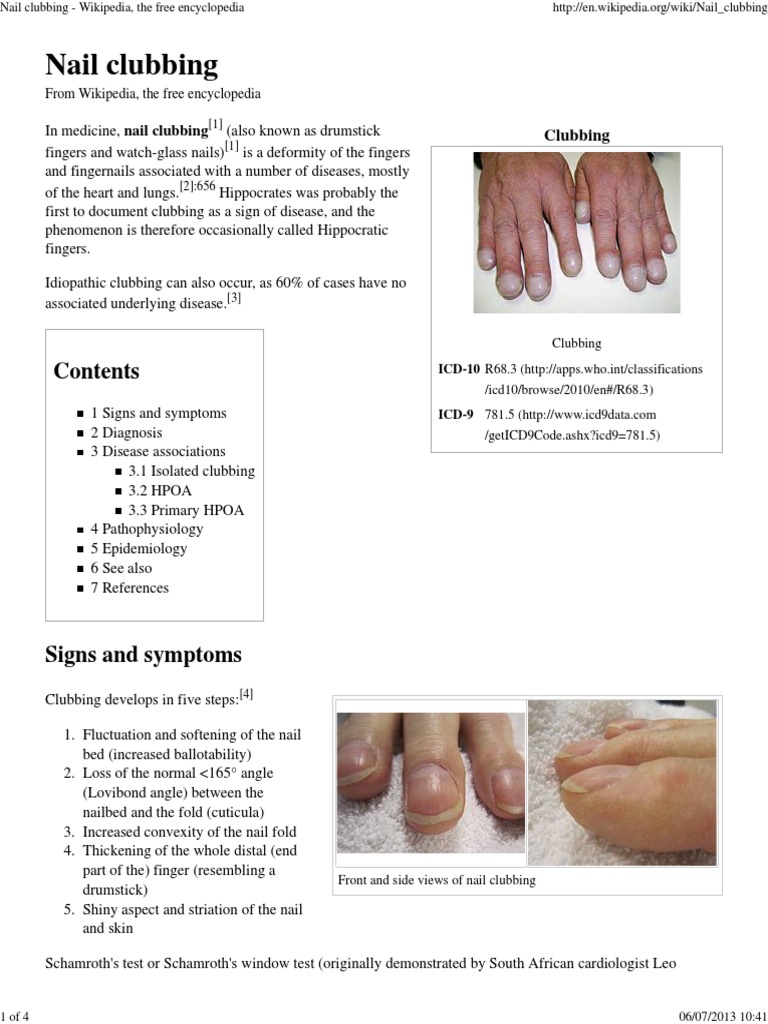 Nail Clubbing Wikipedia, The Free Encyclopedia Diseases And