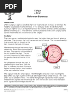 Reference Summary: X-Plain Lasik