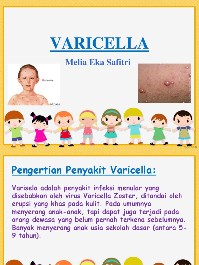 Tatalaksana dan Pengobatan Varicella Anak | PDF | Sains & Matematika