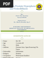 Download ppt bph and vesikolithiasispptx by Putri Dwi Kartini SN178753187 doc pdf