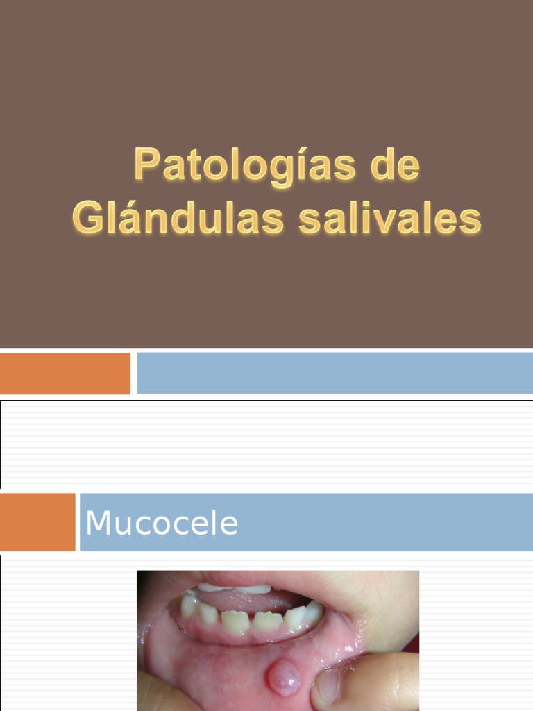 Patologías De Las Glandulas Salivales Pdf Boca Especialidades Medicas