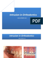 12-Intrusion in Orthodontics-Http://orthofree - Com/en