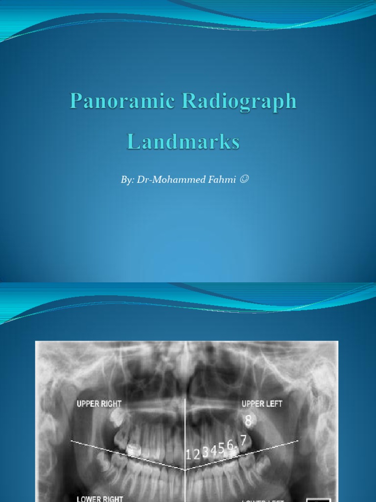 Panoramic Radiograph Landmarks1 | PDF