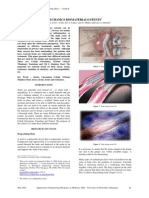 Biomechanics of Stents