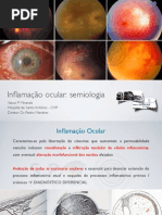 APT - Semiologia Uveítes