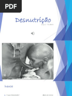 Desnutrição